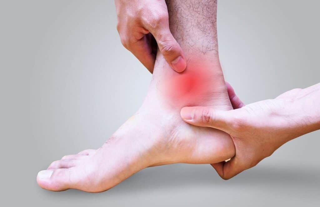 Foot Arthritis