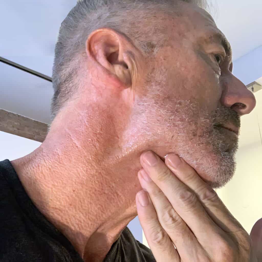 Tackling Turkey Neck: Non-Invasive Treatments to Get Rid of Neck Sagging 2 Tackling Turkey Neck: Non-Invasive Treatments to Get Rid of Neck Sagging 1